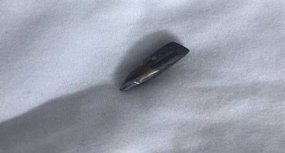 نقل " الجدوع " إلى مستشفى بالرياض بعد إخراج الرصاصة من كتفه