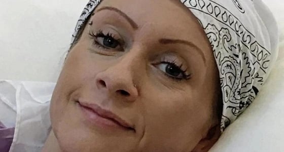 بريطانية تجمع 80 ألف جنيه إسترليني لعلاج طليقة زوجها