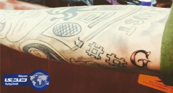 وشمًا جديد متغير الألوان لرصد مستويات الجلوكوز في ثوان