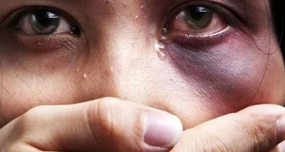 مفاجأة جديدة في قضية " معنفة أبها " بالكشف عن هوية الزوج