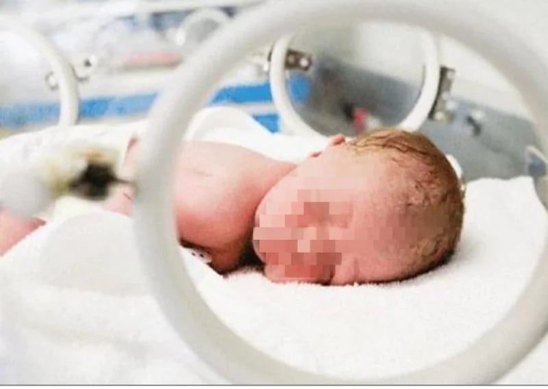 حالة مرضية نادرة لشابة حجم رأسها لا يتوقف عن النمو