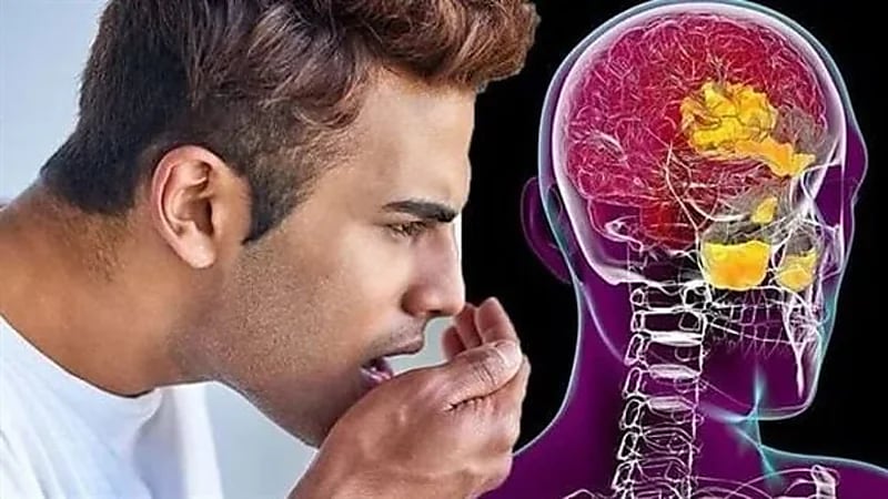 عدم الاهتمام بصحة الفم قد يؤدي لخراجات دماغية قاتلة