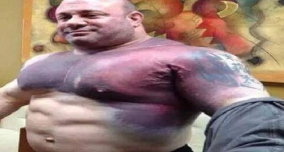 بالفيديو..انفجار عضلات لاعبي كمال الاجسام بسبب العقاقير