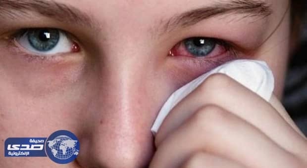 إذا ظهرت هذه العلامات على عينيك.. استشيري الطبيب فورا