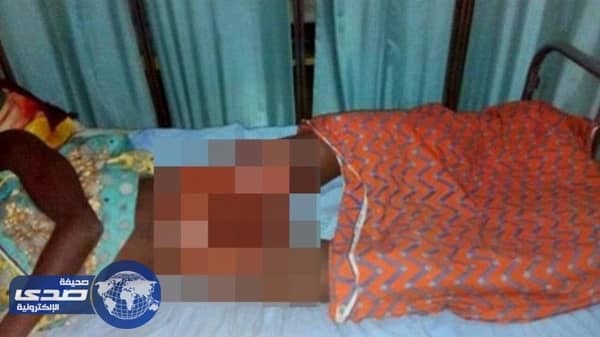 أغتصب طفلتهما .. فأحرقا عضوه الذكري