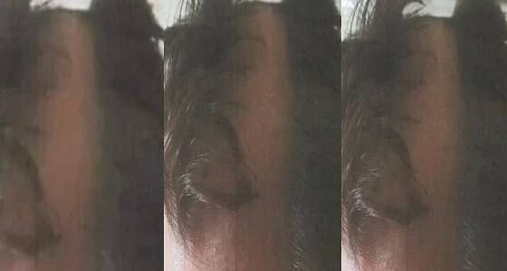 بالفيديو.. حلاق يقص أذن زبون ويتركه بقصة شعر غريبة