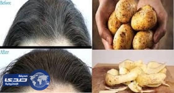 تعرفي على فوائد قشر البطاطا