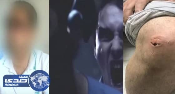 بالفيديو.. أفريقي يهاجم طفل على طريقة الـ " زومبي "