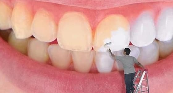 " القرنفل " و " البصل " للقضاء على إصفرار الأسنان