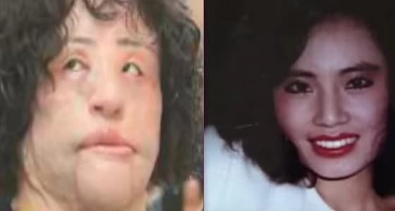بالصور..عمليات تجميل انتهت بنتائج كارثية