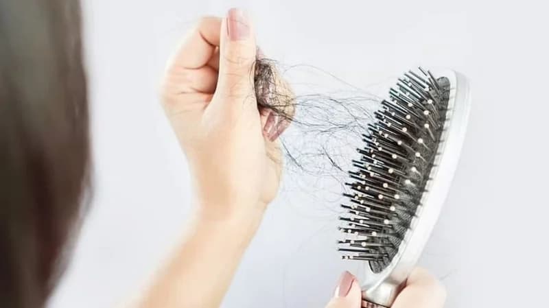 "خبير" يوضح موعد التساقط الموسمي للشعر