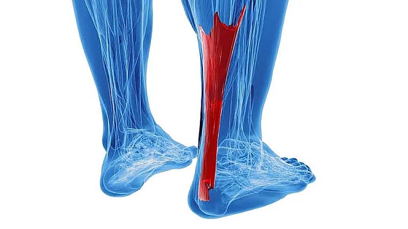علماء يبتكرون طريقة جديدة لعلاج تمزق وتر العرقوب