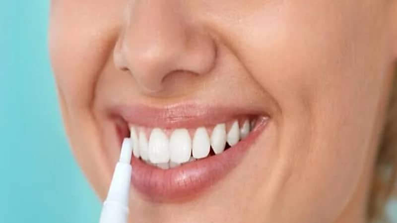 طرق طبيعية لتبييض الأسنان قبل الزفاف