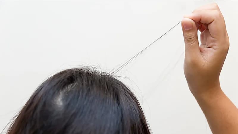 بالفيديو .. أعراض تدل على إصابة الطفل بهوس "نتف الشعر"