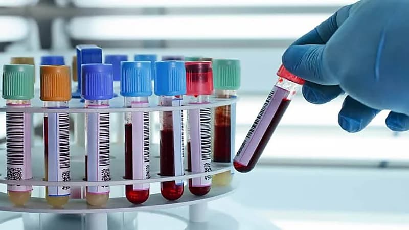 «النمر»: لا تعمل التحاليل إلا في مختبرات معتمدة