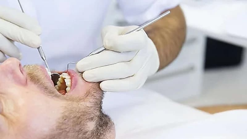 بالفيديو .. أشياء تسبب تآكل العظام بالفم