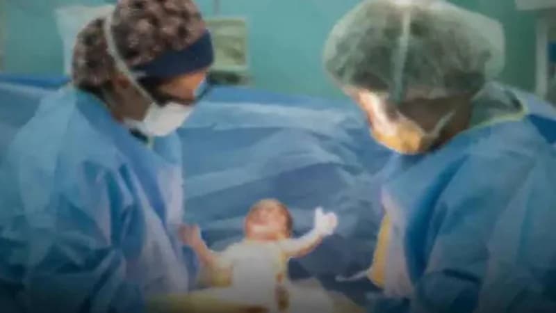 مصر تفرض معايير مشددة لتقليل الولادة القيصرية