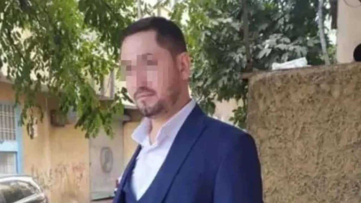 اعتداء وحشي بالأسيد على امرأة خلال خلاف زوجي