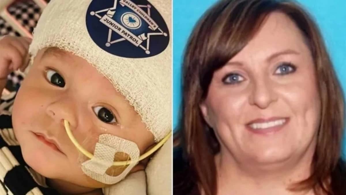 جليسة أطفال متهمة بإلحاق إصابة دماغية بالرضيع وإزالته نصف الجمجمة