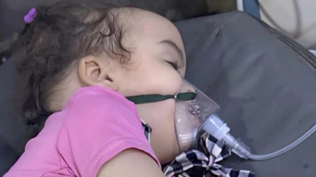 إنقاذ طفلة ابتلعت 15 حبة منع حمل
