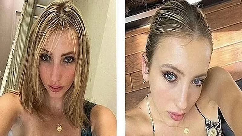 امرأة تكتشف أن قلبها على الجانب الأيمن بدلا من الأيسر