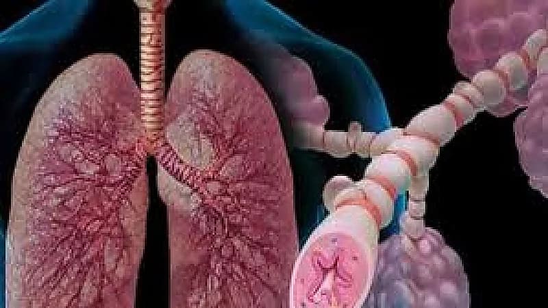 "الانسداد الرئوي" يؤدي إلى الإصابة بالأمراض المزمنة