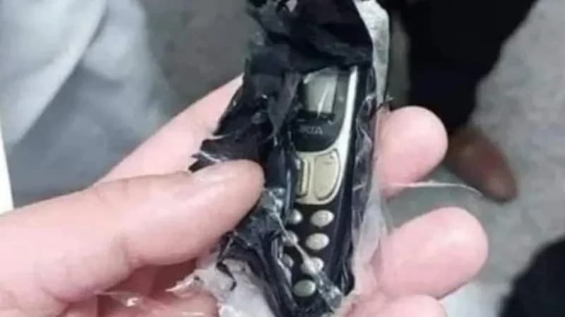 في واقعة غريبة.. استخراج هاتف جوال من بطن شاب مريض