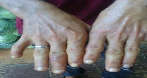 اتلاف 210 كيلو أرز و 4500 ملفوف في مطعم ببحرة